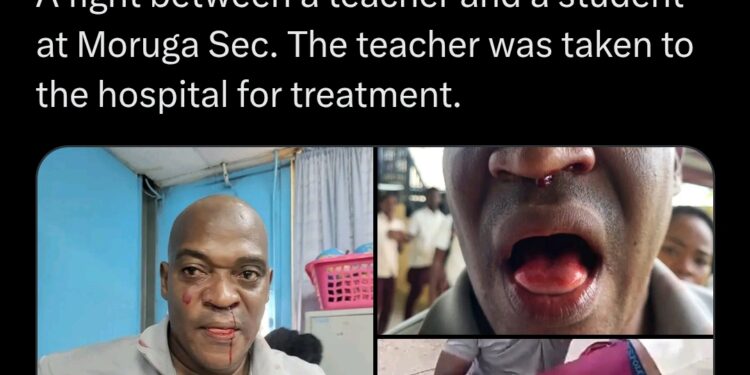 South African student fights teacher