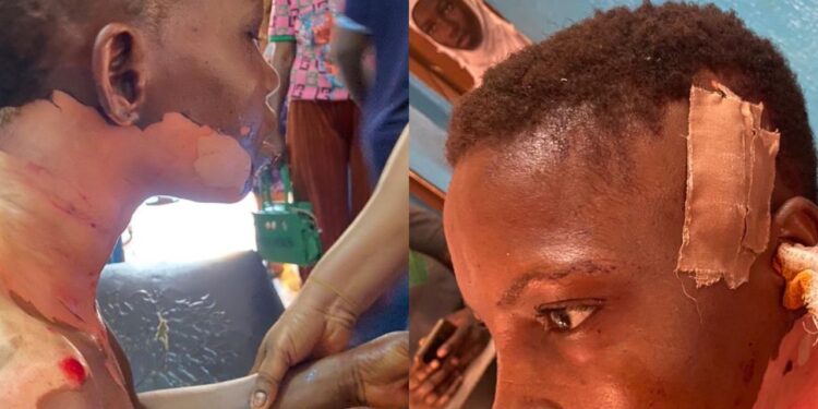 Man stabs and attacks his wife with hot oil in Ogun