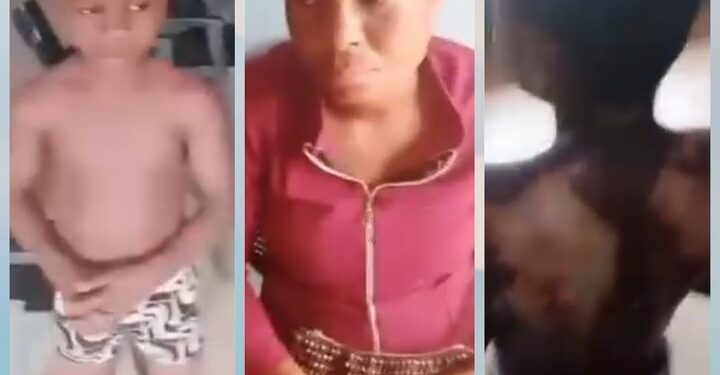 Wicked Nurse Tortures 13-Year-Old Nephew With Heated Iron In Anambra