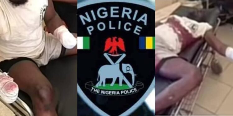 Wife allegedly cuts off husband’s hands after he buys iPhone 16 for side chick