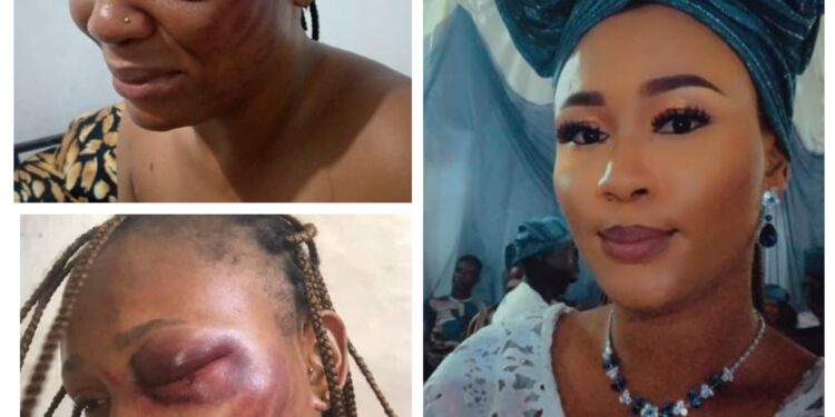 15 years in abusive relationship with a beast has cost me my left eye – Nigerian woman cries out for help over domestic violence