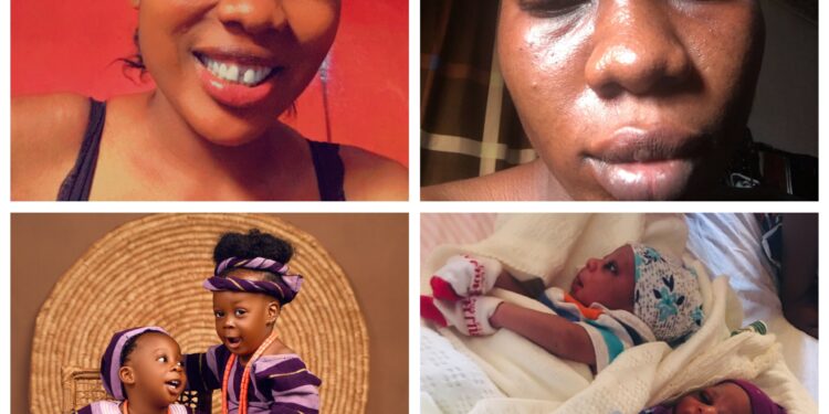 Nigerian woman narrates how her poly lecturer boyfriend allegedly abandoned her with twin pregnancy and relocated abroad