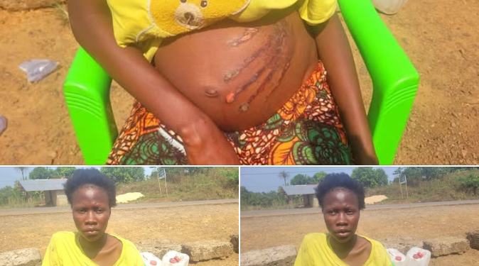 Pregnant woman claims she woke up to find bloody handprint on her belly after slapping a ‘spirit’ in her dream
