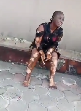 Four children, pregnant woman and 15 others injured in Rivers gas explosion (video)