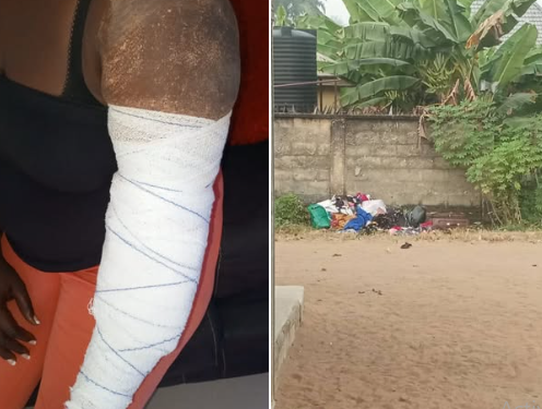 Man beats his wife with steering lock in Abia, breaking her bones