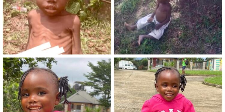 Amazing transformation of toddler rescued after being accused of witchcraft and left to die in Akwa Ibom