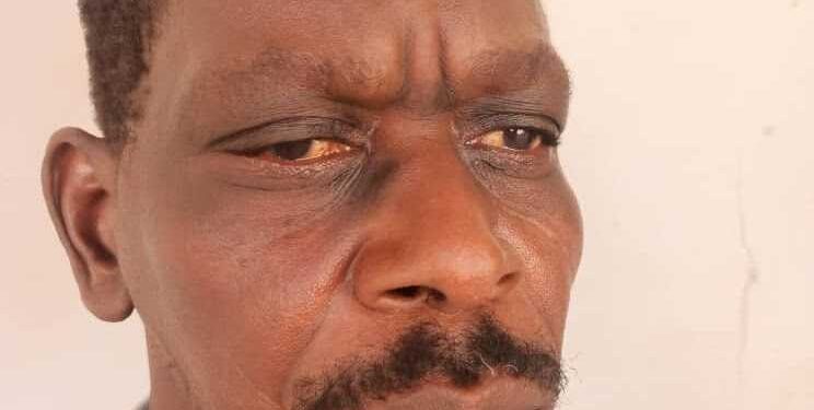 Man digs stepfather’s grave and cuts off head in Adamawa