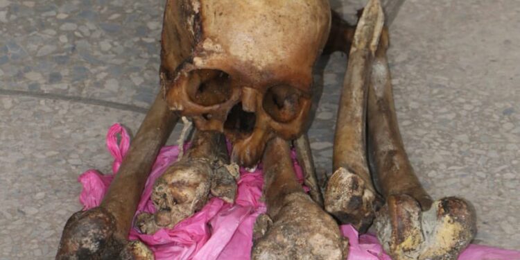 Man arrested with human skull and bones in Abuja, reveals he intended to sell them for N600,000