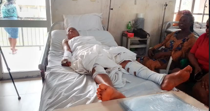 Man gouges out his wife’s eyes for alleged money ritual in Abia