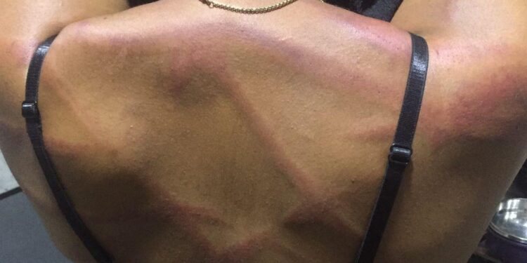 LASU final year student demands for justice after she was allegedly battered by her Landlord and his mum